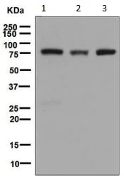 Western blot - Anti-Phospholipase A2 activator protein (PLAP) antibody [EPR5481] (AB133589)