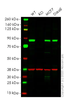 Western blot - Anti-Phospholipase A2 activator protein (PLAP) antibody [EPR5481] - BSA and Azide free (AB248568)