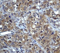 Immunohistochemistry (Formalin/PFA-fixed paraffin-embedded sections) - Anti-Phospholipase A2 activator protein (PLAP) antibody [Y102] (AB32354)
