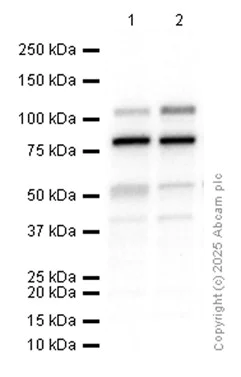 Western blot - Anti-Phospholipase A2 activator protein (PLAP) antibody [Y102] - BSA and Azide free (AB247246)