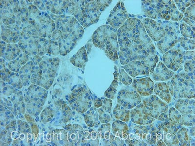 Immunohistochemistry (Formalin/PFA-fixed paraffin-embedded sections) - Anti-phospholipase A2 antibody (AB23705)