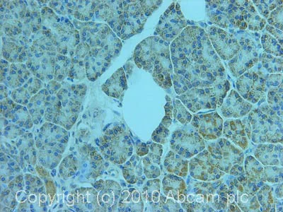 Immunohistochemistry (Formalin/PFA-fixed paraffin-embedded sections) - Anti-phospholipase A2 antibody (AB23705)