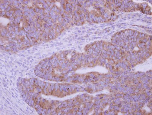 Immunohistochemistry (Formalin/PFA-fixed paraffin-embedded sections) - Anti-Phospholipase A2 XII/PLA2G12A antibody (AB227477)