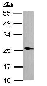Western blot - Anti-Phospholipase A2 XII/PLA2G12A antibody (AB227477)