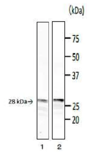 Western blot - Anti-Phospholipase C antibody [bc-01] (AB243181)