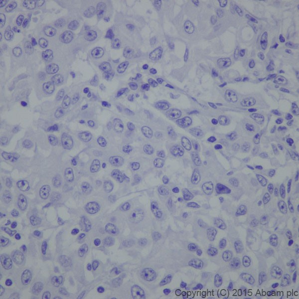 Immunohistochemistry (Formalin/PFA-fixed paraffin-embedded sections) - Anti-Phospholipase C beta 1/PLCB1 antibody [EPR19085] (AB182359)