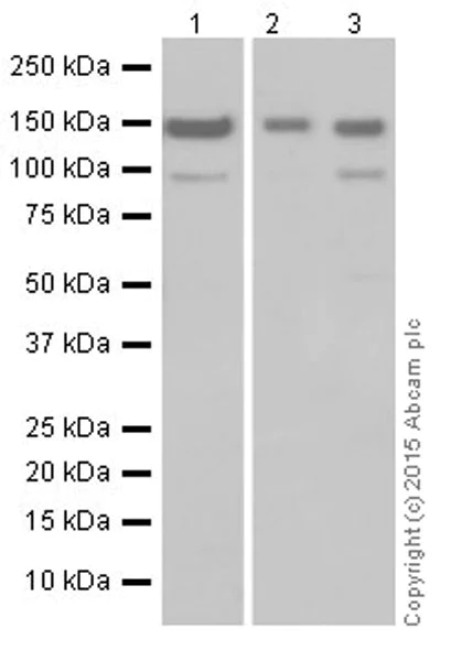 Western blot - Anti-Phospholipase C beta 1/PLCB1 antibody [EPR19085] (AB182359)