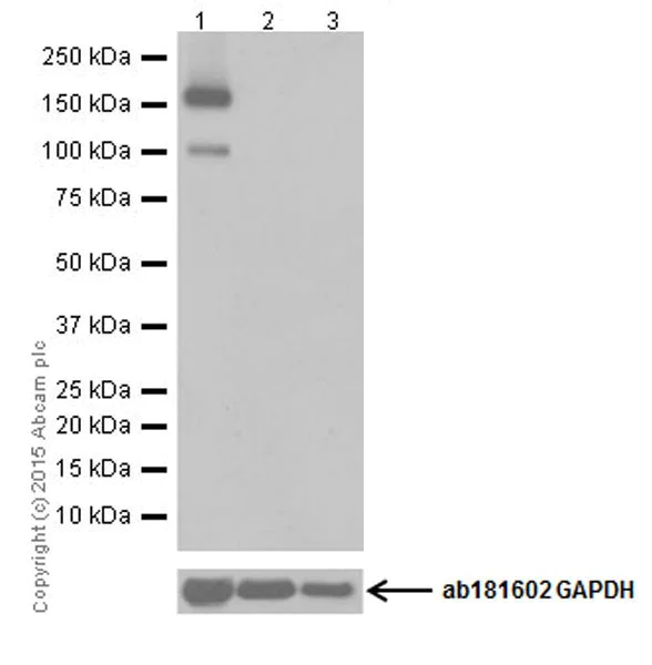 Western blot - Anti-Phospholipase C beta 1/PLCB1 antibody [EPR19085] (AB182359)