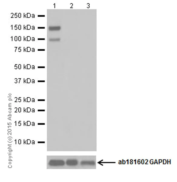 Western blot - Anti-Phospholipase C beta 1/PLCB1 antibody [EPR19085] (AB182359)