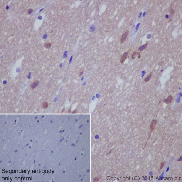 Immunohistochemistry (Formalin/PFA-fixed paraffin-embedded sections) - Anti-Phospholipase C beta 1/PLCB1 + Phospholipase C beta 3/PLCB3 antibody [EPR18714] (AB184743)