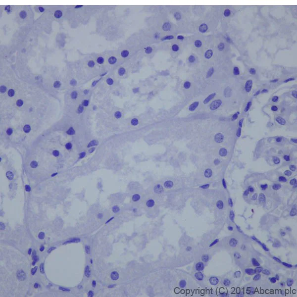 Immunohistochemistry (Formalin/PFA-fixed paraffin-embedded sections) - Anti-Phospholipase C beta 1/PLCB1 + Phospholipase C beta 3/PLCB3 antibody [EPR18714] (AB184743)