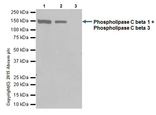 Immunoprecipitation - Anti-Phospholipase C beta 1/PLCB1 + Phospholipase C beta 3/PLCB3 antibody [EPR18714] (AB184743)