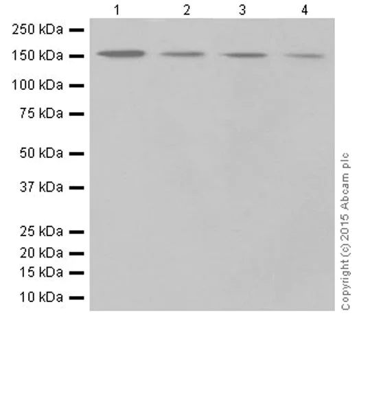 Western blot - Anti-Phospholipase C beta 1/PLCB1 + Phospholipase C beta 3/PLCB3 antibody [EPR18714] (AB184743)