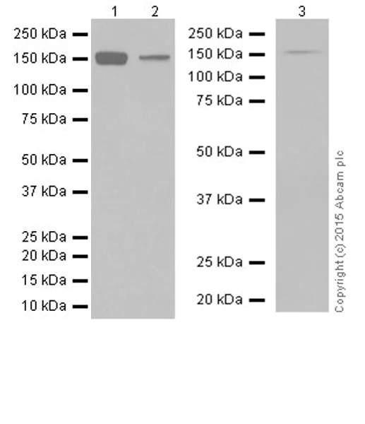 Western blot - Anti-Phospholipase C beta 1/PLCB1 + Phospholipase C beta 3/PLCB3 antibody [EPR18714] (AB184743)