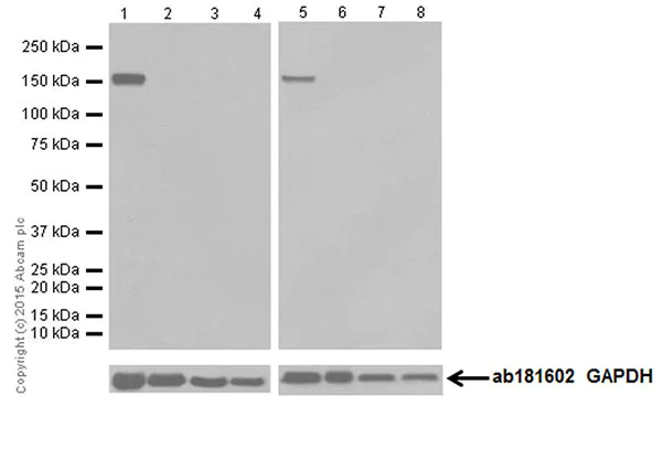 Western blot - Anti-Phospholipase C beta 1/PLCB1 + Phospholipase C beta 3/PLCB3 antibody [EPR18714] (AB184743)