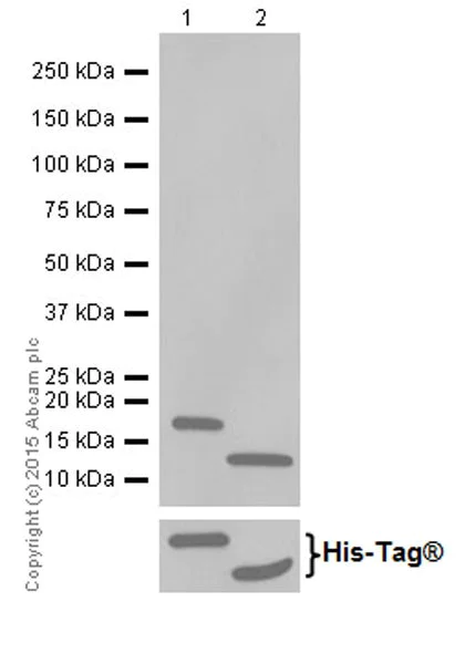 Western blot - Anti-Phospholipase C beta 1/PLCB1 + Phospholipase C beta 3/PLCB3 antibody [EPR18714] (AB184743)