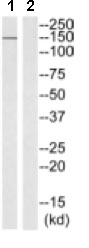 Western blot - Anti-Phospholipase C beta 2/PLCB2 antibody (AB129889)