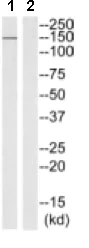 Western blot - Anti-Phospholipase C beta 2/PLCB2 antibody (AB129889)