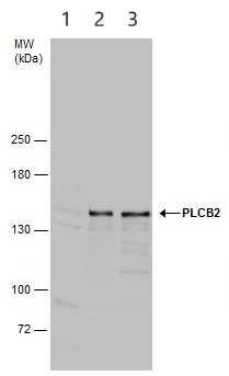 Western blot - Anti-Phospholipase C beta 2/PLCB2 antibody (AB272919)