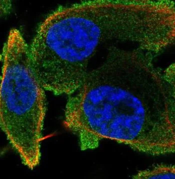 Immunocytochemistry/ Immunofluorescence - Anti-Phospholipase C beta 2/PLCB2 antibody - C-terminal (AB220285)