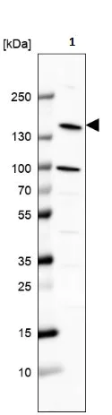 Western blot - Anti-Phospholipase C beta 2/PLCB2 antibody - C-terminal (AB220285)