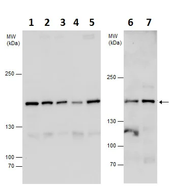 Western blot - Anti-Phospholipase C beta 3/PLCB3 antibody (AB228794)