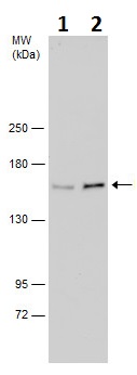 Western blot - Anti-Phospholipase C beta 3/PLCB3 antibody (AB228794)