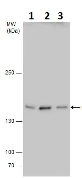 Western blot - Anti-Phospholipase C beta 3/PLCB3 antibody (AB228794)