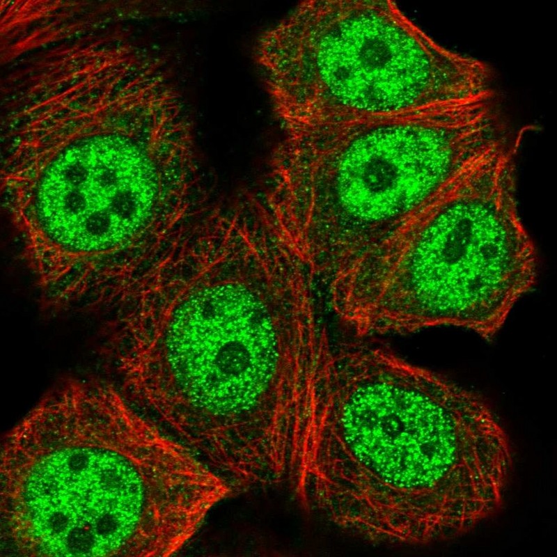 Immunocytochemistry/ Immunofluorescence - Anti-Phospholipase C beta 3/PLCB3 antibody (AB251862), expandable thumbnail