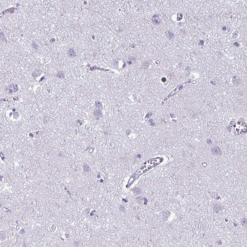 Immunohistochemistry (Formalin/PFA-fixed paraffin-embedded sections) - Anti-Phospholipase C beta 3/PLCB3 antibody (ab251862), expandable thumbnail
