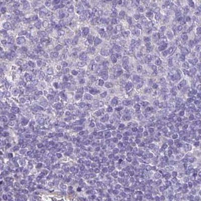 Immunohistochemistry (Formalin/PFA-fixed paraffin-embedded sections) - Anti-Phospholipase C beta 3/PLCB3 antibody (AB251862), expandable thumbnail