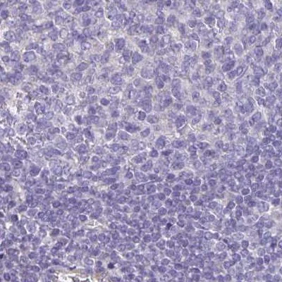 Immunohistochemistry (Formalin/PFA-fixed paraffin-embedded sections) - Anti-Phospholipase C beta 3/PLCB3 antibody (AB251862)