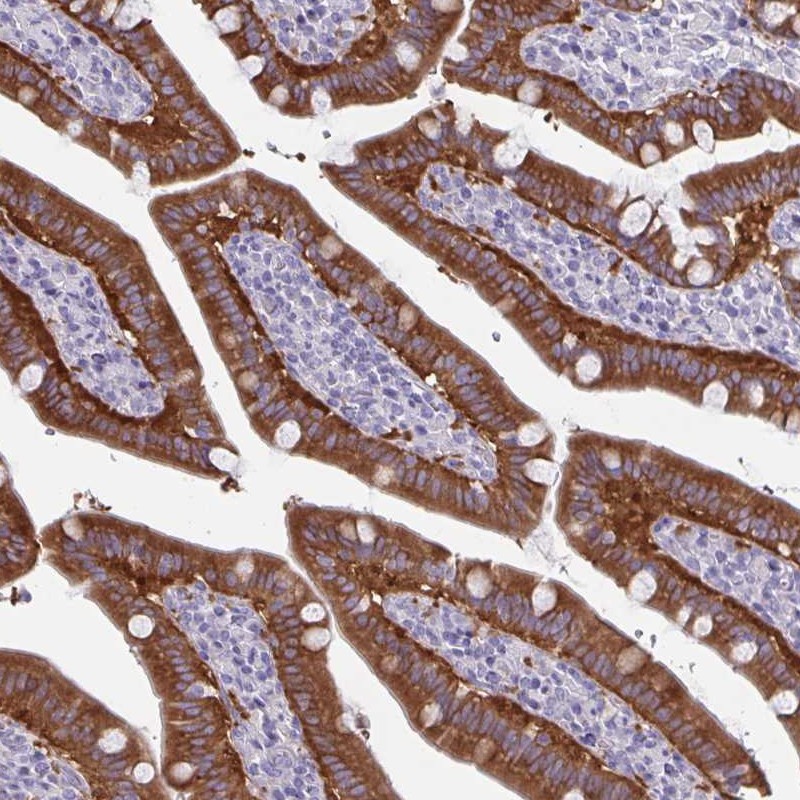 Immunohistochemistry (Formalin/PFA-fixed paraffin-embedded sections) - Anti-Phospholipase C beta 3/PLCB3 antibody (AB251862), expandable thumbnail