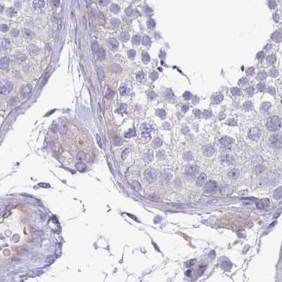 Immunohistochemistry (Formalin/PFA-fixed paraffin-embedded sections) - Anti-Phospholipase C beta 3/PLCB3 antibody (AB251862), expandable thumbnail
