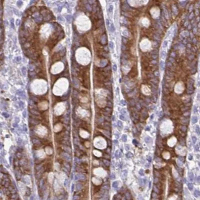 Immunohistochemistry (Formalin/PFA-fixed paraffin-embedded sections) - Anti-Phospholipase C beta 3/PLCB3 antibody (AB251862)