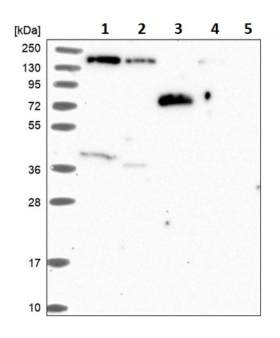 Western blot - Anti-Phospholipase C beta 3/PLCB3 antibody (ab251862), expandable thumbnail