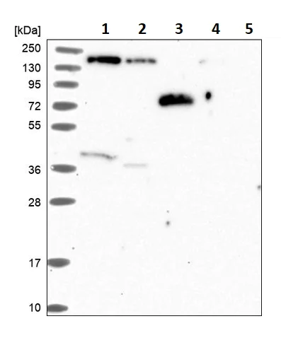 Western blot - Anti-Phospholipase C beta 3/PLCB3 antibody (AB251862)