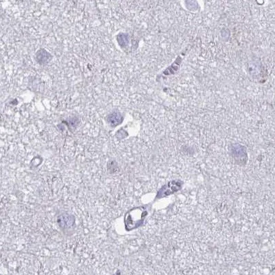Immunohistochemistry (Formalin/PFA-fixed paraffin-embedded sections) - Anti-Phospholipase C beta 3/PLCB3 antibody (AB251898)
