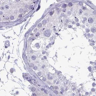 Immunohistochemistry (Formalin/PFA-fixed paraffin-embedded sections) - Anti-Phospholipase C beta 3/PLCB3 antibody (AB251898)