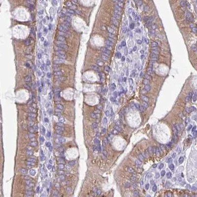 Immunohistochemistry (Formalin/PFA-fixed paraffin-embedded sections) - Anti-Phospholipase C beta 3/PLCB3 antibody (AB251898)