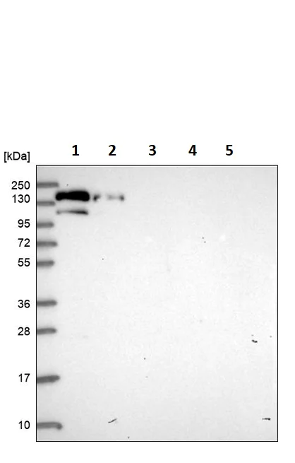 Western blot - Anti-Phospholipase C beta 3/PLCB3 antibody (AB251898)