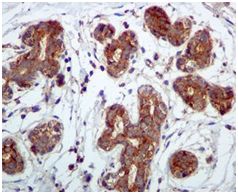 Immunohistochemistry (Formalin/PFA-fixed paraffin-embedded sections) - Anti-Phospholipase C beta 3/PLCB3 antibody [EPR5951] (AB124735)