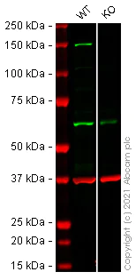 Western blot - Anti-Phospholipase C beta 3/PLCB3 antibody [EPR5951] (AB124735)