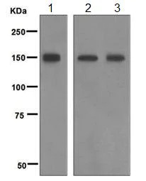 Western blot - Anti-Phospholipase C beta 3/PLCB3 antibody [EPR5951] (AB124735)