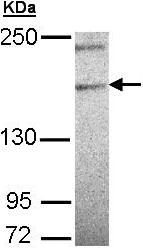 Western blot - Anti-Phospholipase c eta 1 antibody (AB97751)