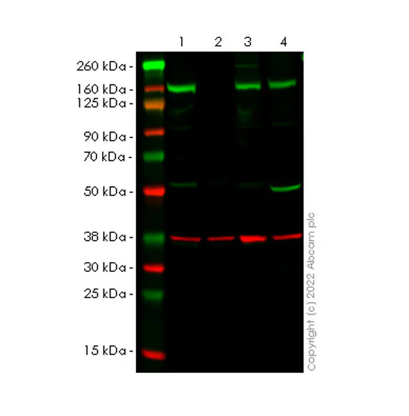Western blot - Anti-Phospholipase C gamma 1/PLC-gamma-1 antibody [10-PLC-gamma] (AB302940)