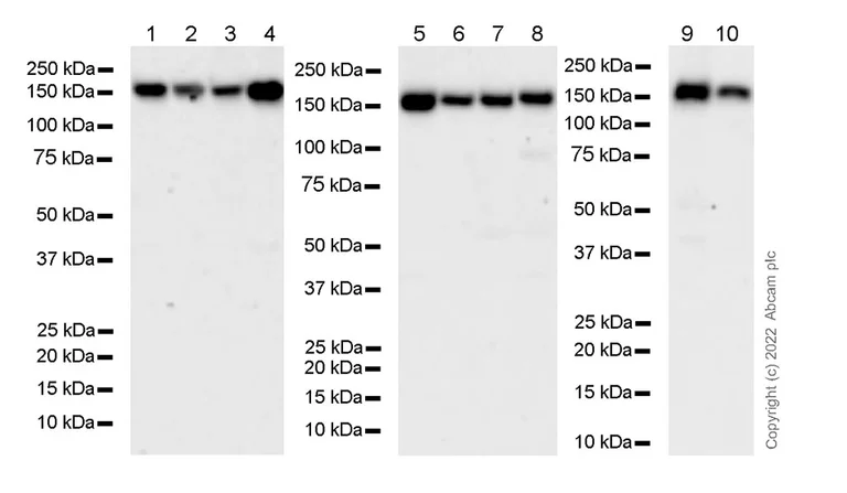 Western blot - Anti-Phospholipase C gamma 1/PLC-gamma-1 antibody [10-PLC-gamma] (AB302940)