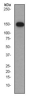 Western blot - Anti-Phospholipase C gamma 1/PLC-gamma-1 antibody [EP1898-7Y] (AB76155)