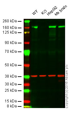 Western blot - Anti-Phospholipase C gamma 1/PLC-gamma-1 antibody [EP1898-7Y] (AB76155)