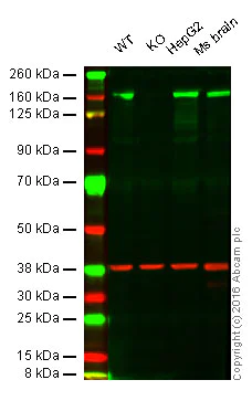 Western blot - Anti-Phospholipase C gamma 1/PLC-gamma-1 antibody [EP1898-7Y] - BSA and Azide free (AB239878)